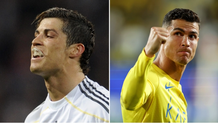 Why Cristiano Ronaldo wore special mouthguard during matches and surprising reason revealed