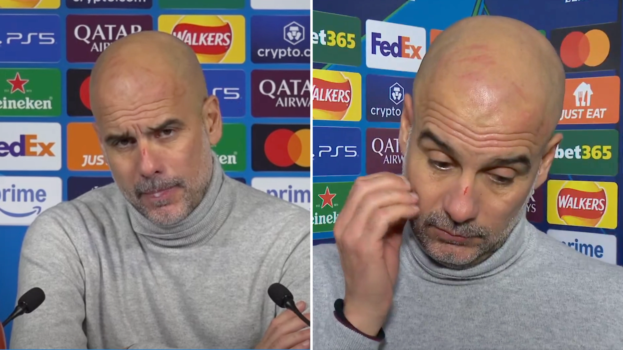Pep Guardiola explains why he had scratches all over his face during interview after Man City's collapse against Feyenoord