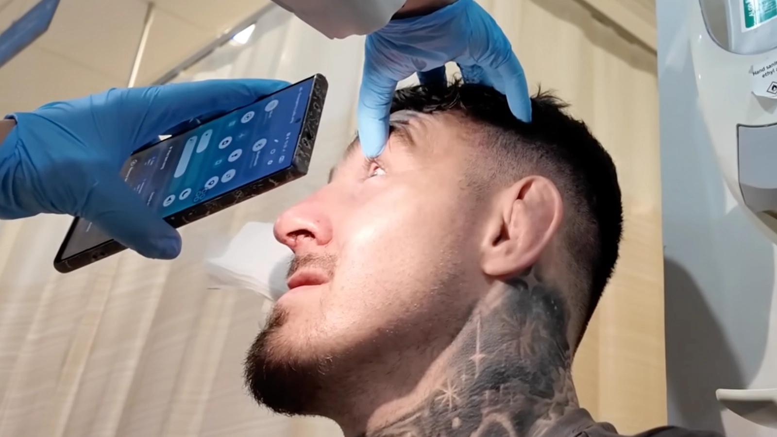Close-Up Footage Shows True Extent of Damage to Tom Aspinall's Eye