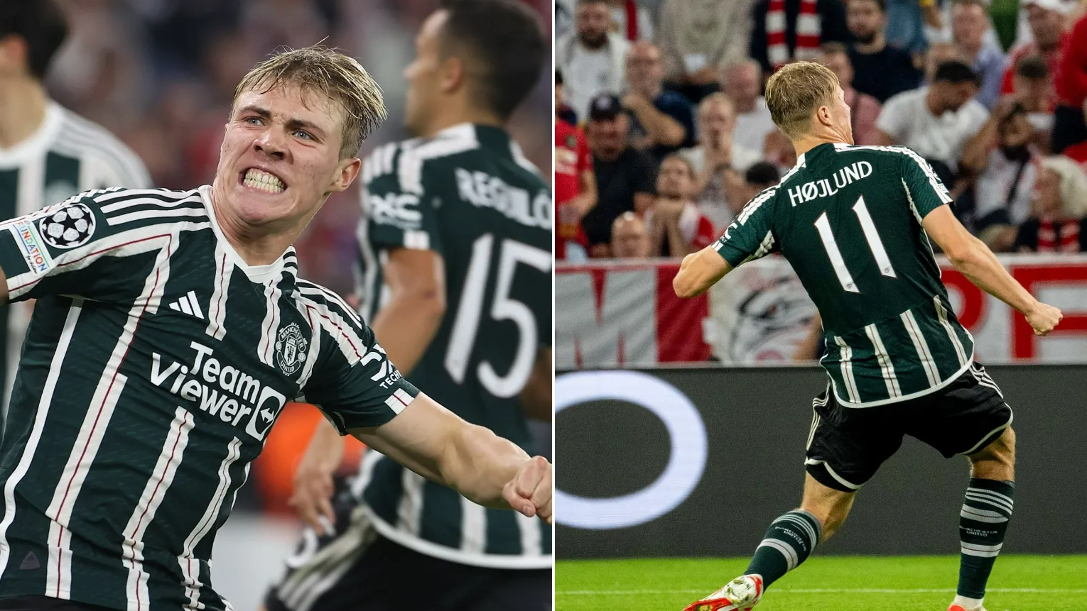Pictures of Rasmus Hojlund's back after Burnley game shows he's had 'cupping therapy'