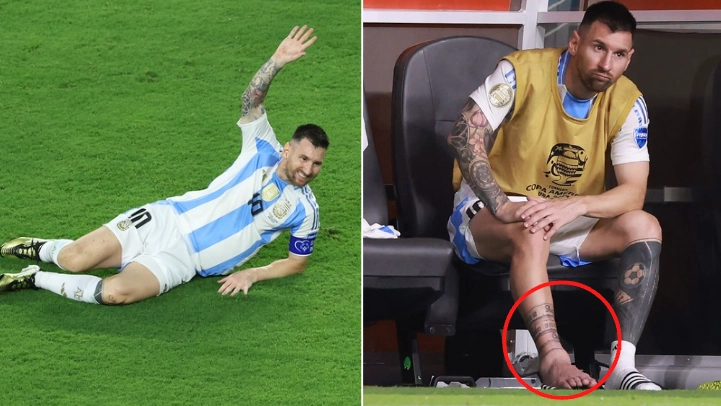 Inter Miami make Lionel Messi statement following 'horror injury' during Copa America final