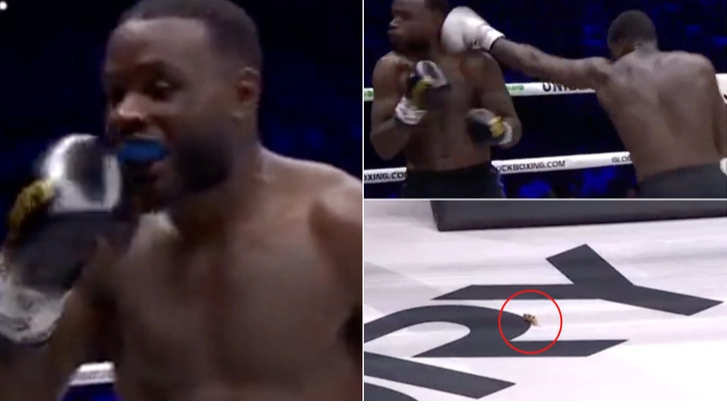 Kickboxer loses row of front teeth in horror incident during fight