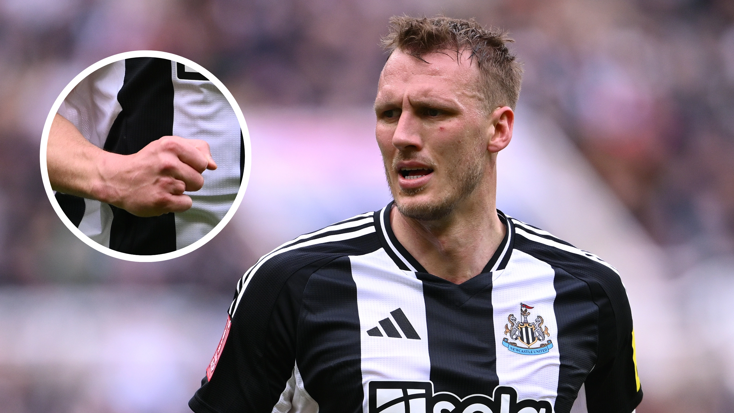 Gruesome reason why Dan Burn is missing a finger as he receives first England call-up from Thomas Tuchel 