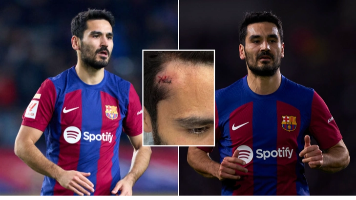 Ilkay Gundogan forced to spend time in hospital to end 2023 after bizarre incident