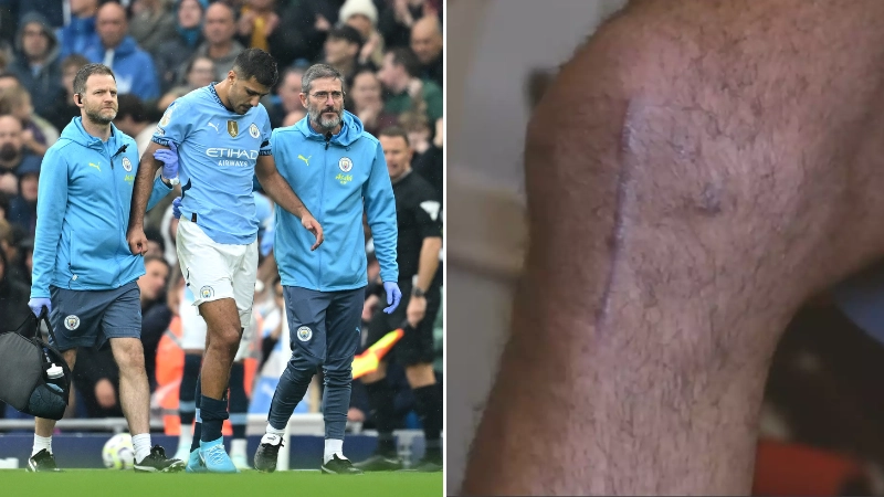 Fans express concern after major Rodri injury update emerges just two months into recovery