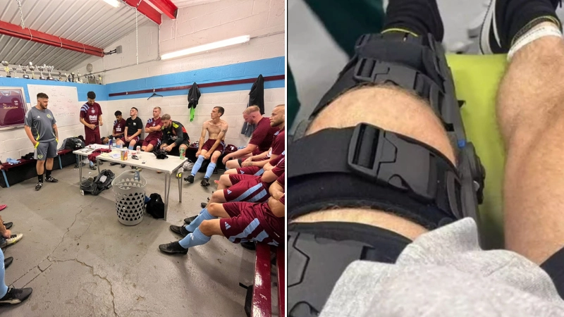 UK football team attacked with baseball bats after game as player suffers 'life-changing injuries'