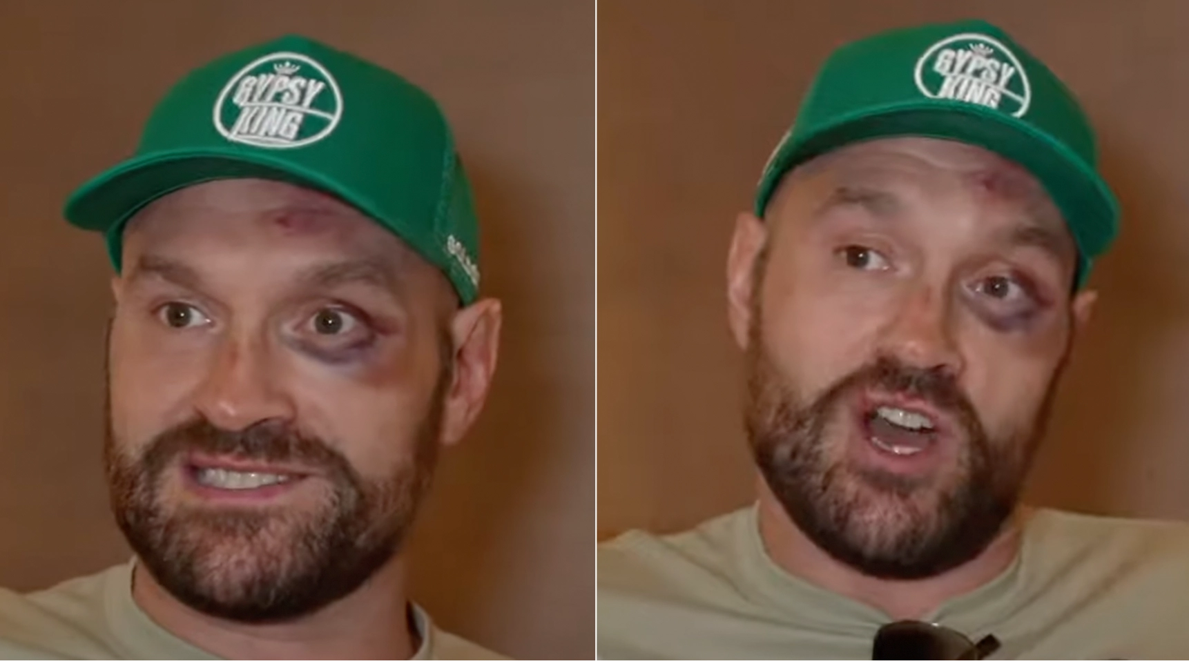 Tyson Fury brutally honest on Francis Ngannou victory in first interview since fight