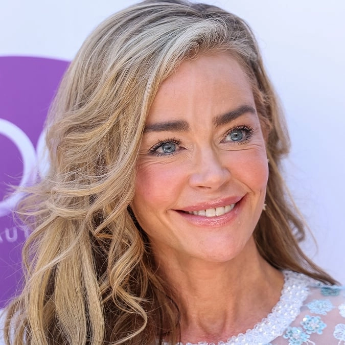 Surgeon explains advanced facelift technique behind Denise Richards' $200,000 transformation