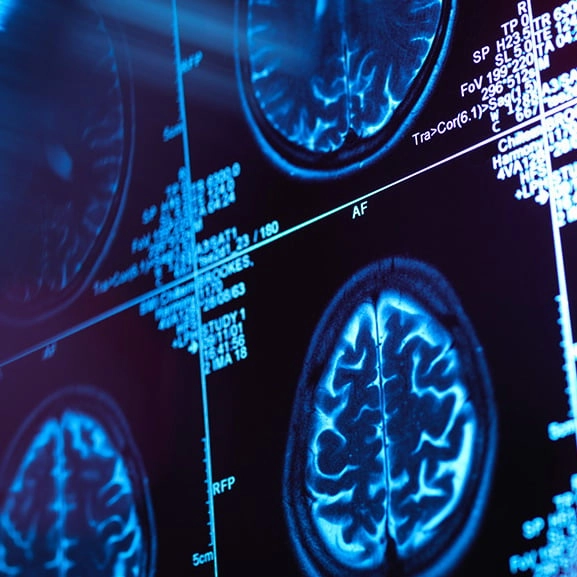 South Korean scientists develop world’s first remote device which can control human minds