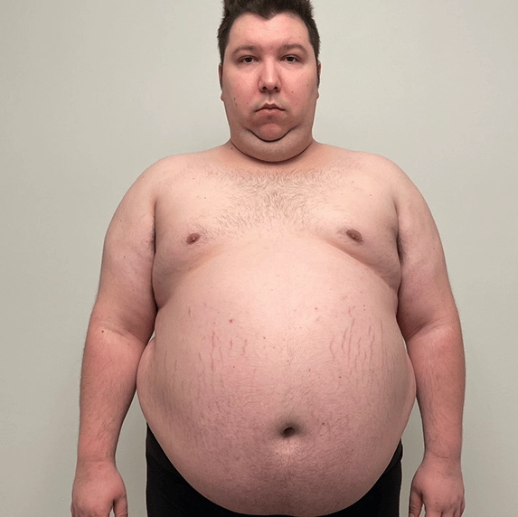 Nikocado Avocado breaks silence revealing the real reason behind his elaborate 250lb weight loss 'social experiment'