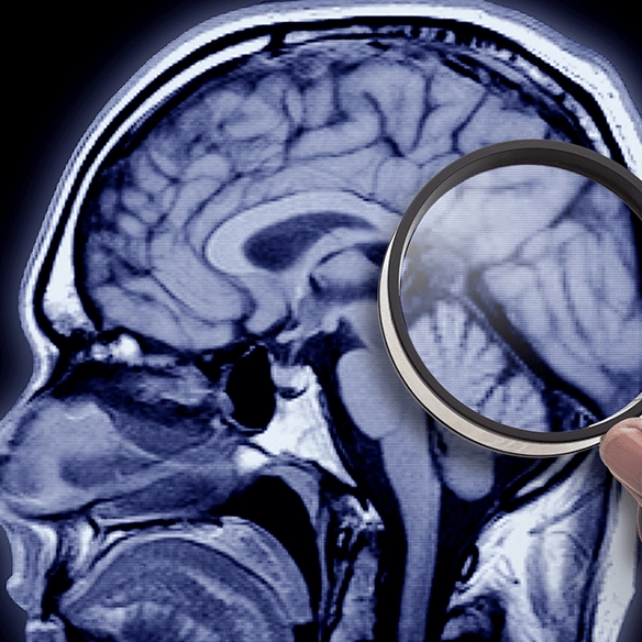 Scientists reveal why we forget some memories and remember others