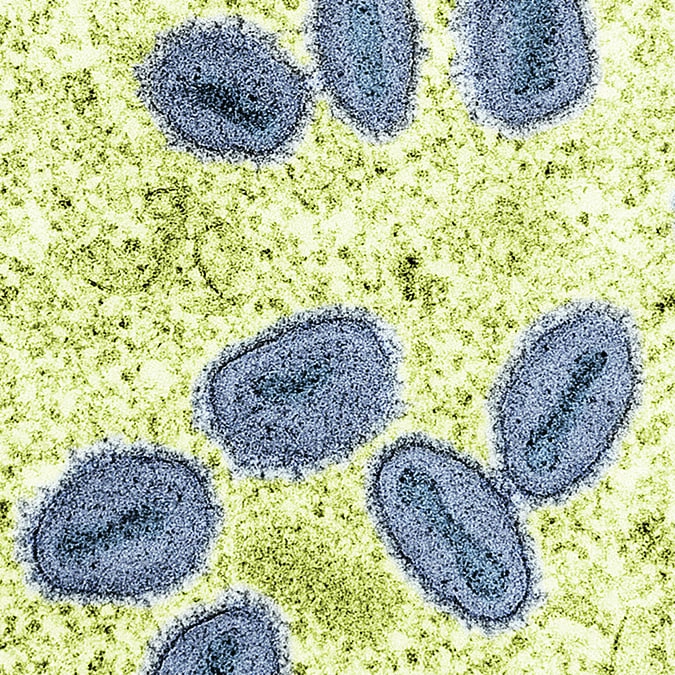 Two scientists charged in alleged scheme to smuggle deadly virus into US