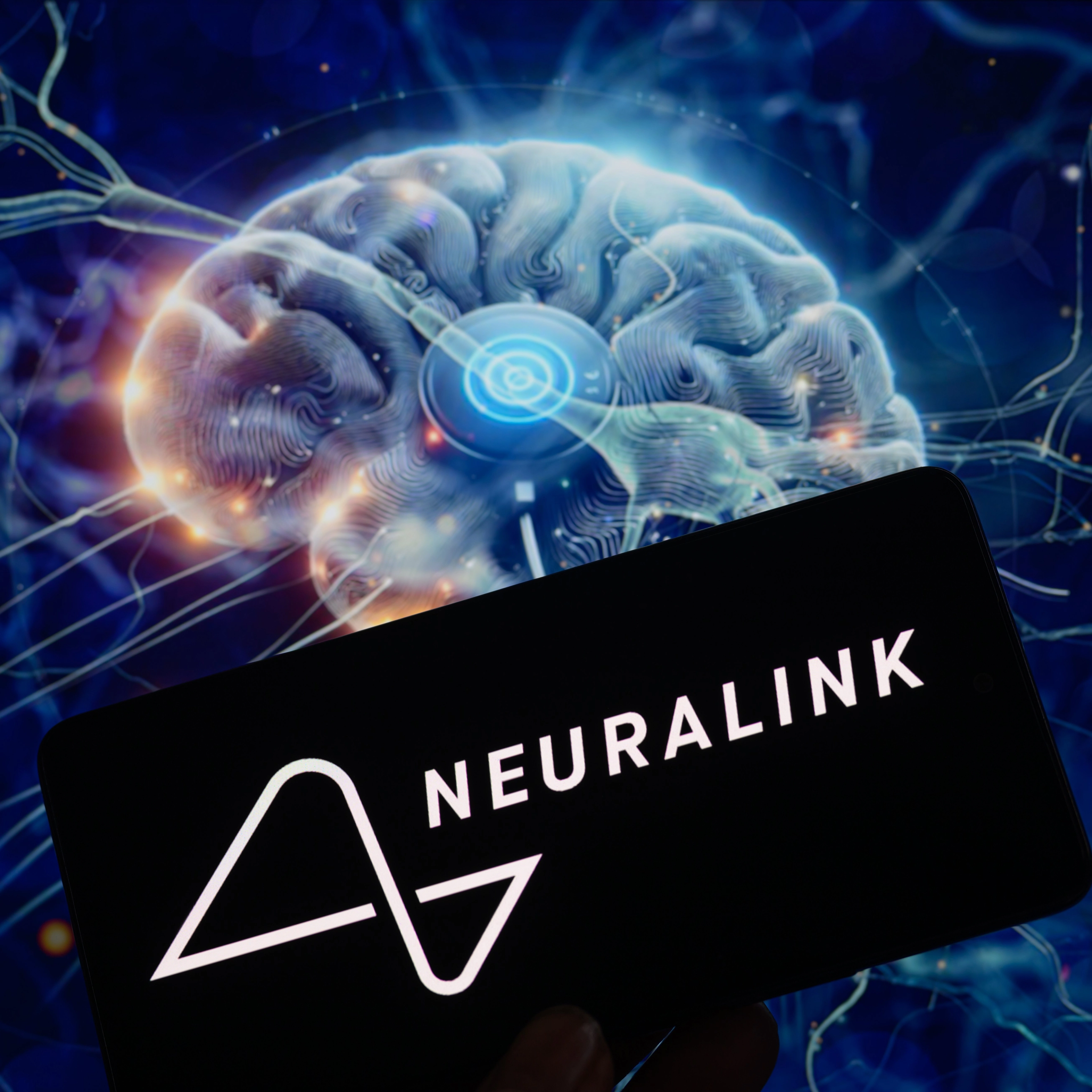 How Elon Musk's Neuralink could help people with vision loss see again
