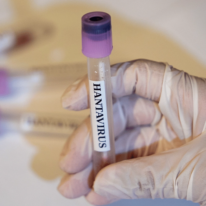 'Terrifying' simulation shows exactly what deadly Hantavirus does to the human body