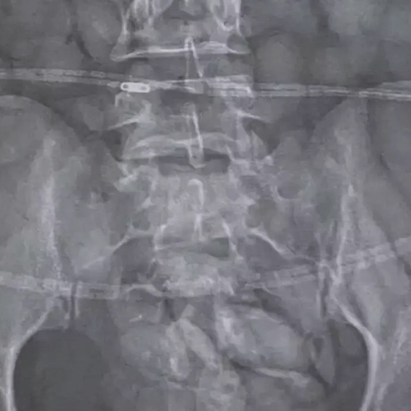 Women immediately arrested at airport security after staff made shocking discovery from looking at her X-ray