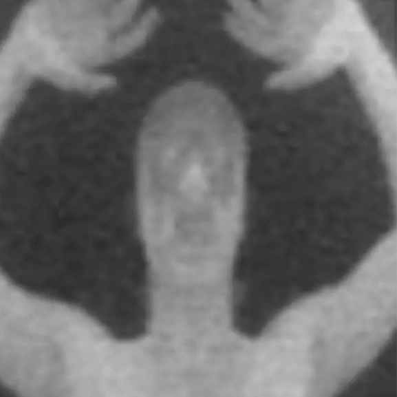 Horrifying reality of what airport security are able to see when you walk through X-ray machine