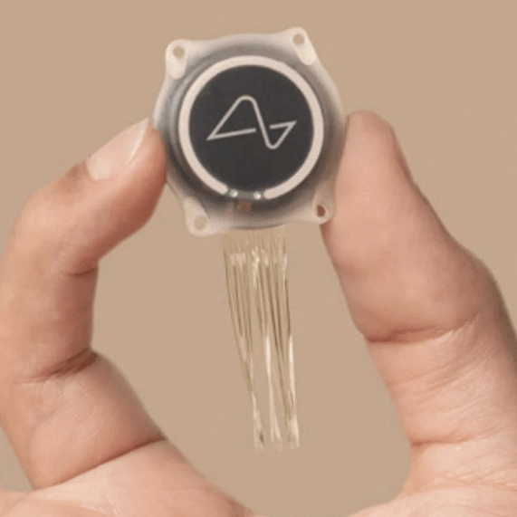 Neuralink’s first in-human brain implant has experienced a malfunction