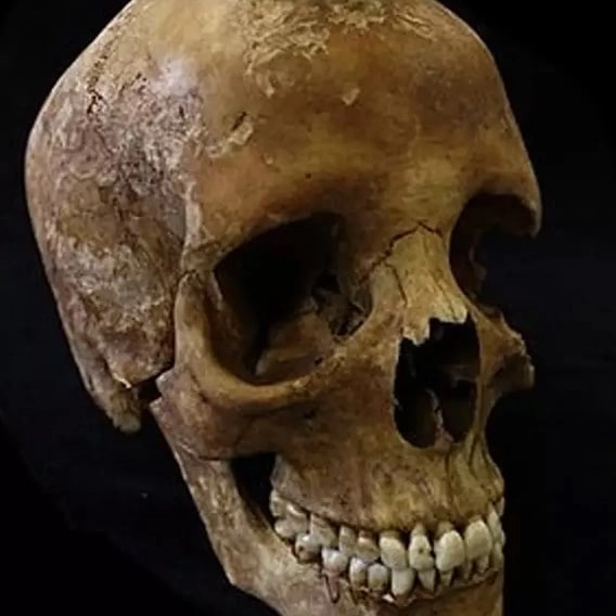 Horrifying images show what really happens to your body after you die when you smoke