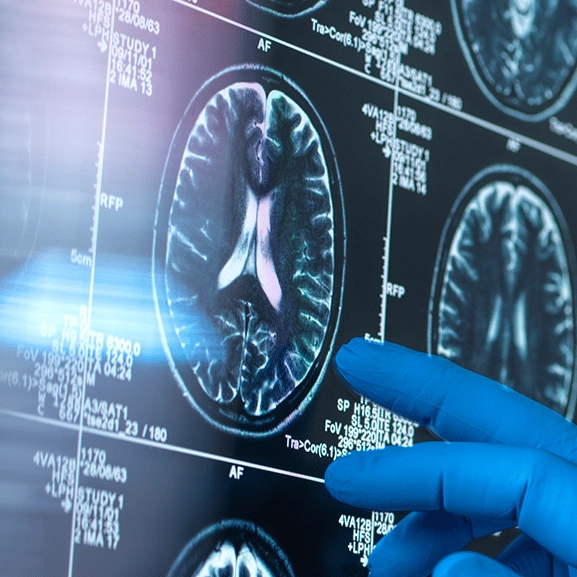 Scientists have measured the exact speed of human thought and the results are fascinating