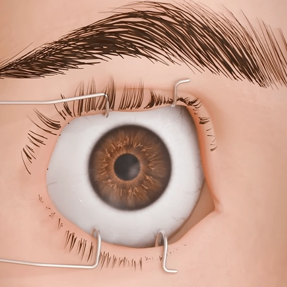 Eerie animation shows everything that would happen to you body if you didn't blink for a few hours
