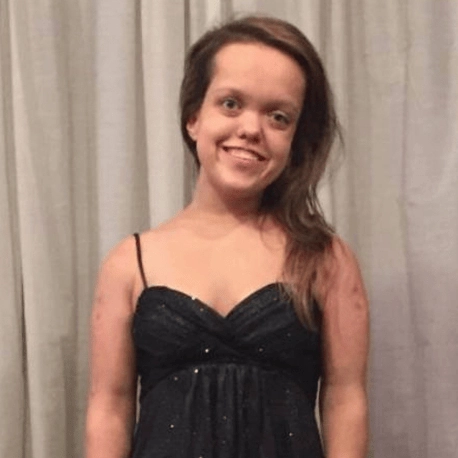 Woman who underwent life-changing limb lengthening surgery to grow 13 inches reveals what she looks like today