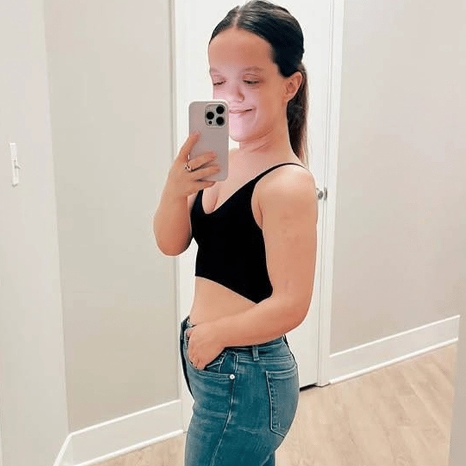 Simulation shows exactly how limb lengthening surgery works as woman reveals appearance after growing 13 inches