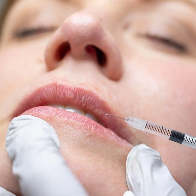 Creepy simulation shows worrying side effect of lip filler people didn't know about