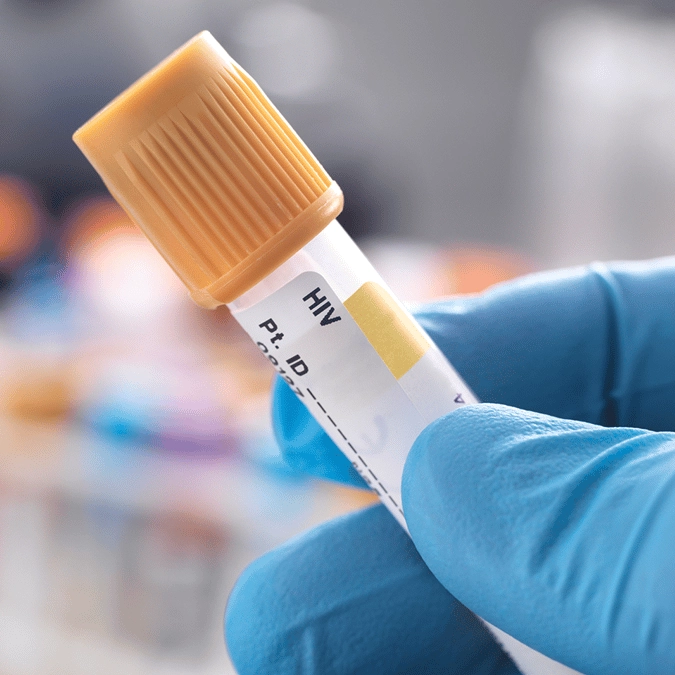 Man 'cured' of HIV following discovery of brother's rare genetic mutation