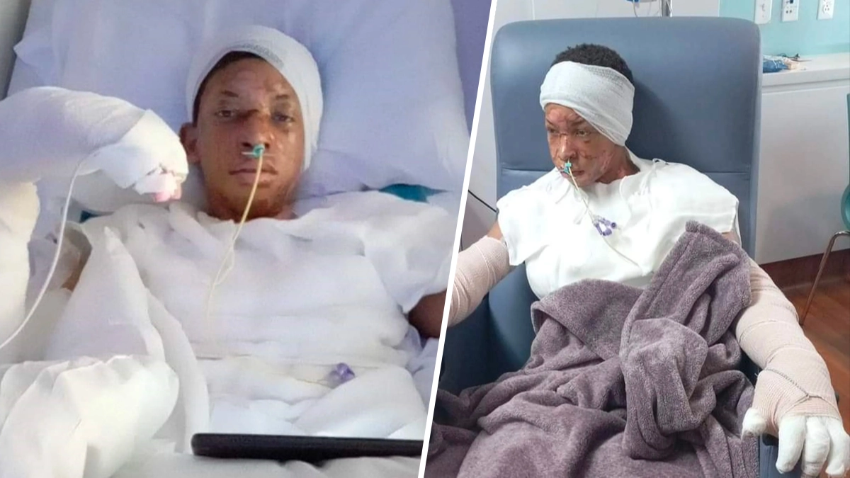 Boy left hospitalised after social media challenge involving alcohol and fire