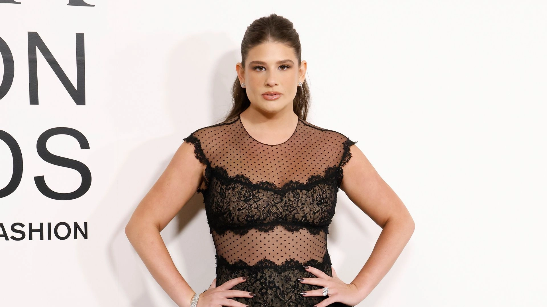 Remi Bader Opens Up About “Brutal” Weight Loss Surgery After Trying Ozempic