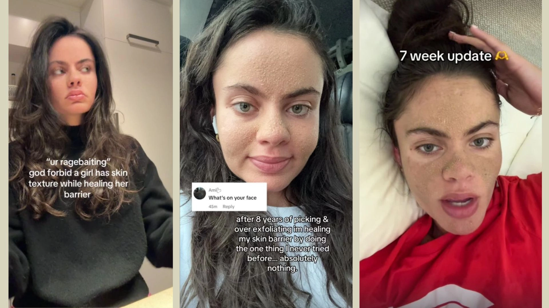 Caveman Skincare Is Trending Thanks To This TikToker — But Will It Get You Glowing Results Or An Infection?