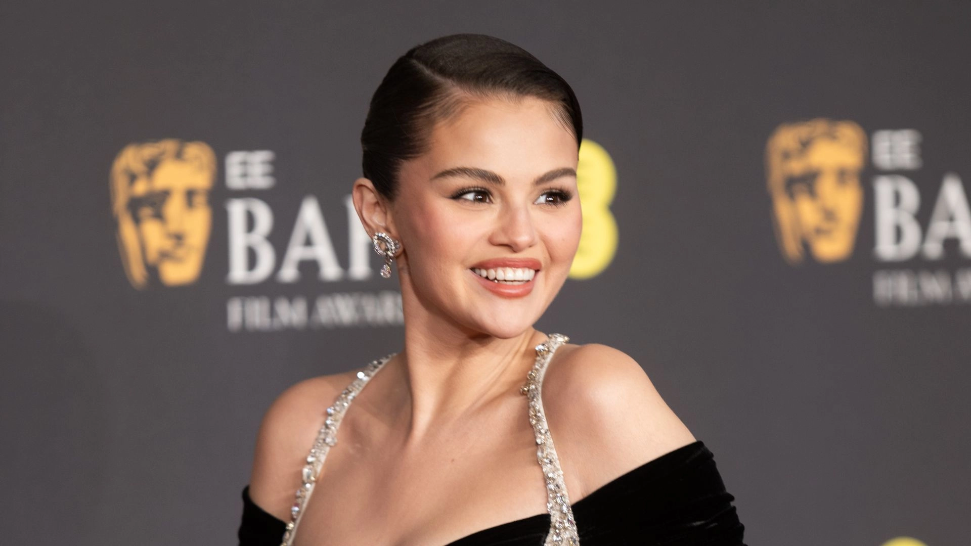 Selena Gomez’s New Smile Has The Internet Convinced She Got Veneers
