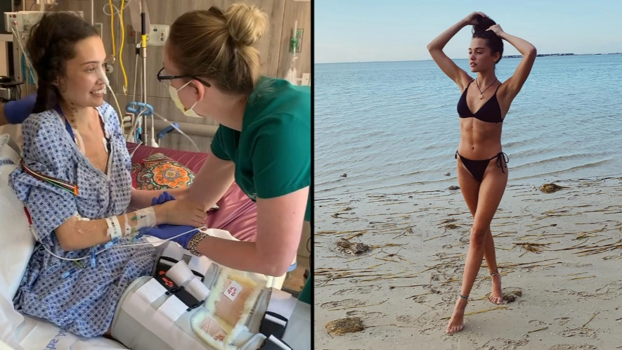 Aspiring Model Loses Her Legs Due To Covid-19 Complications