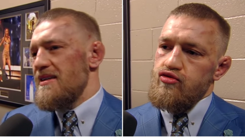 Conor McGregor Gave The 'Greatest Post-Fight Interview After A Loss' Following His Defeat To Nate Diaz