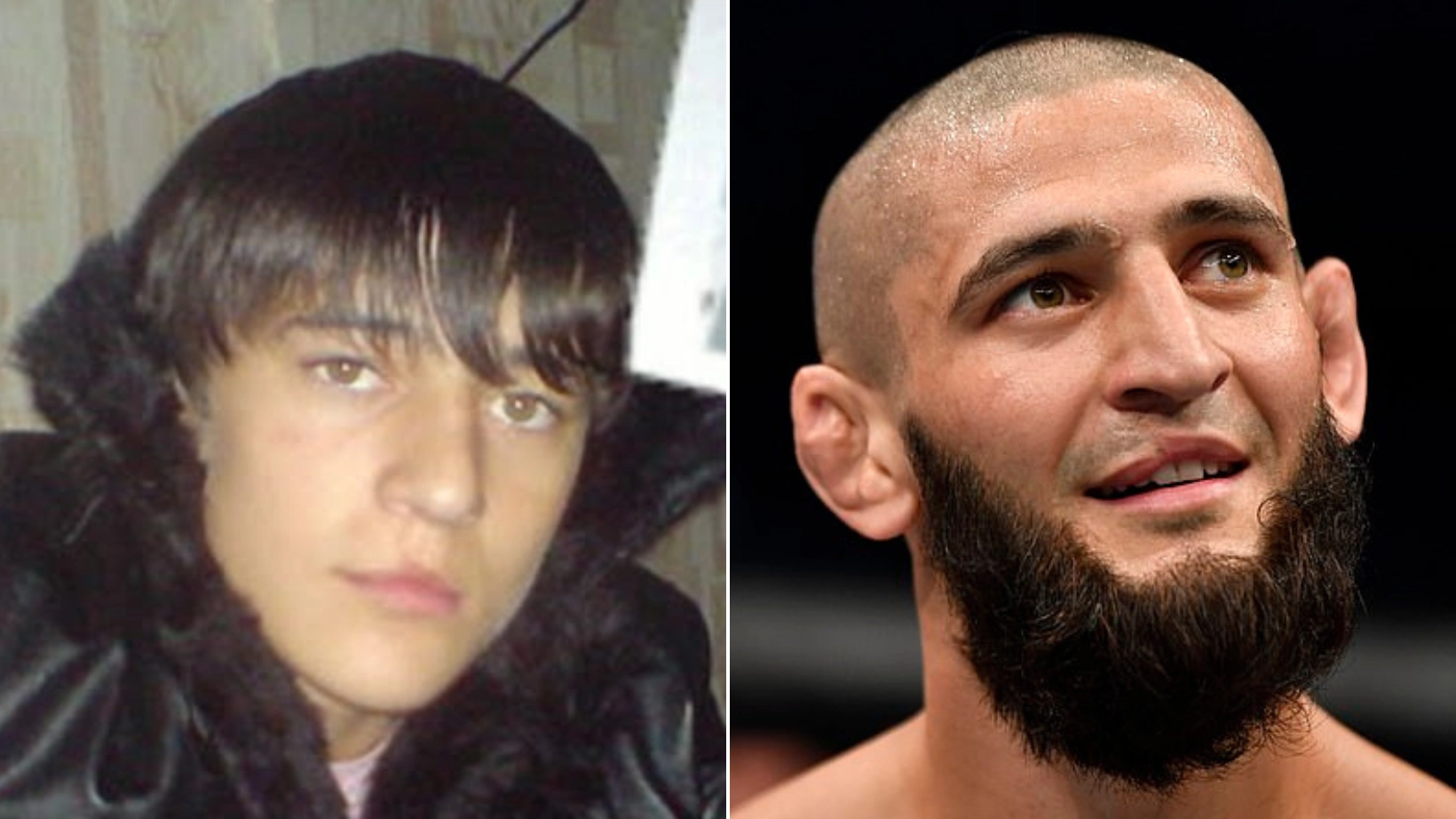 The Gruesome Story Behind Khamzat Chimaev's Lip Scar That Still Causes Him Problems To This Day
