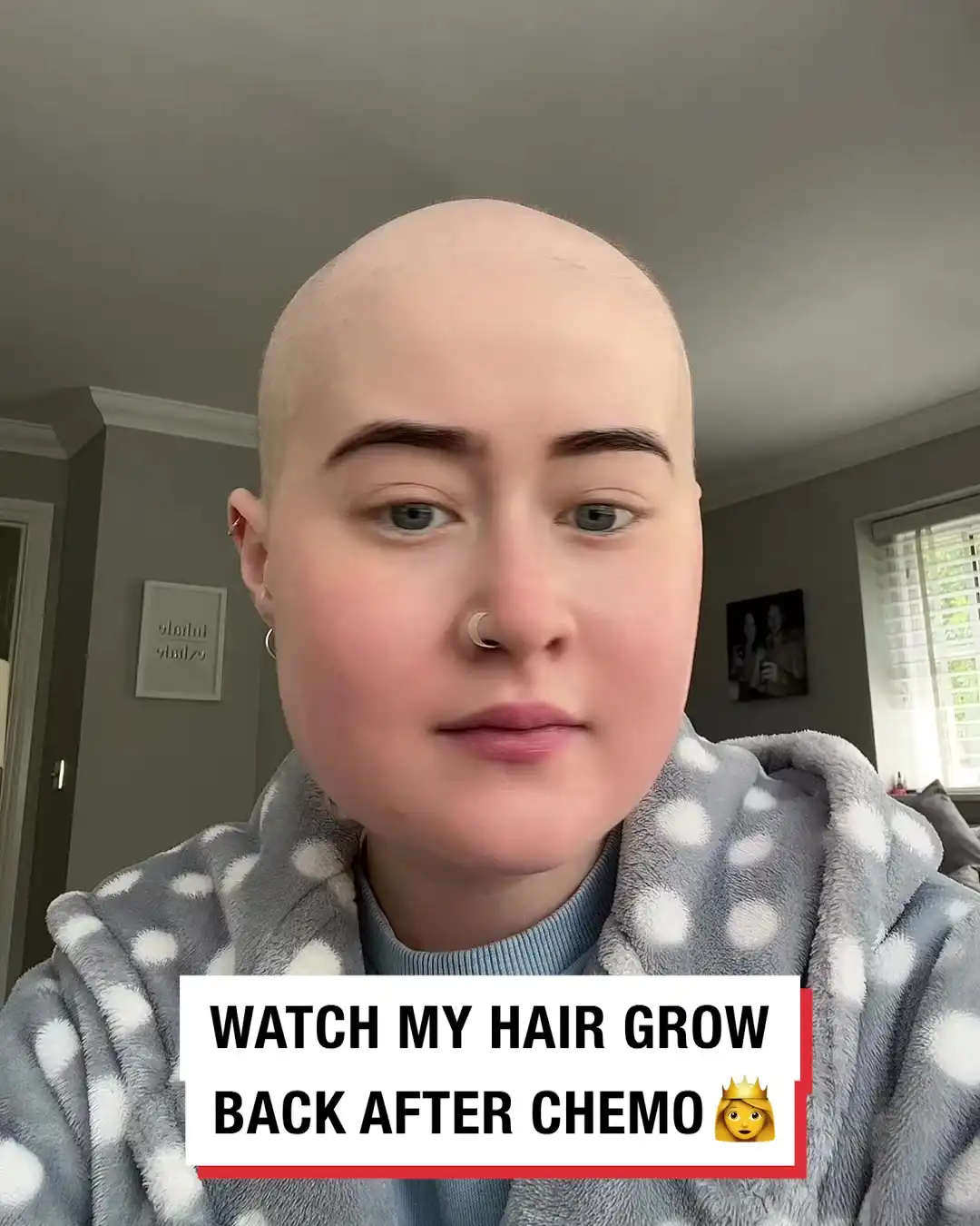 Watch my hair grow back after chemo