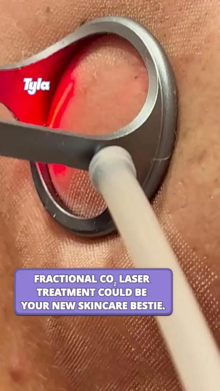 The newest skincare craze 😲✨