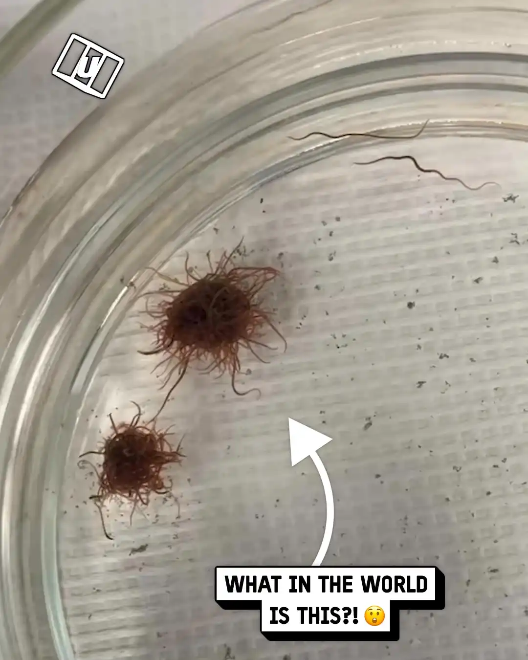 My job gives me the ick 🤢🪱