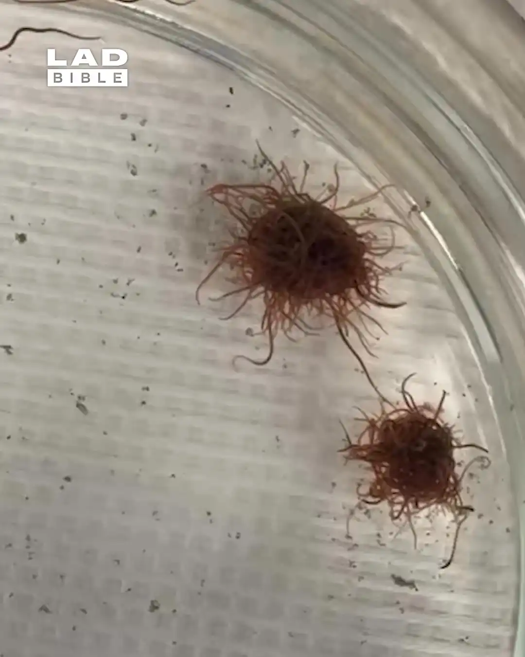 My job gives me the ick 🪱🤢