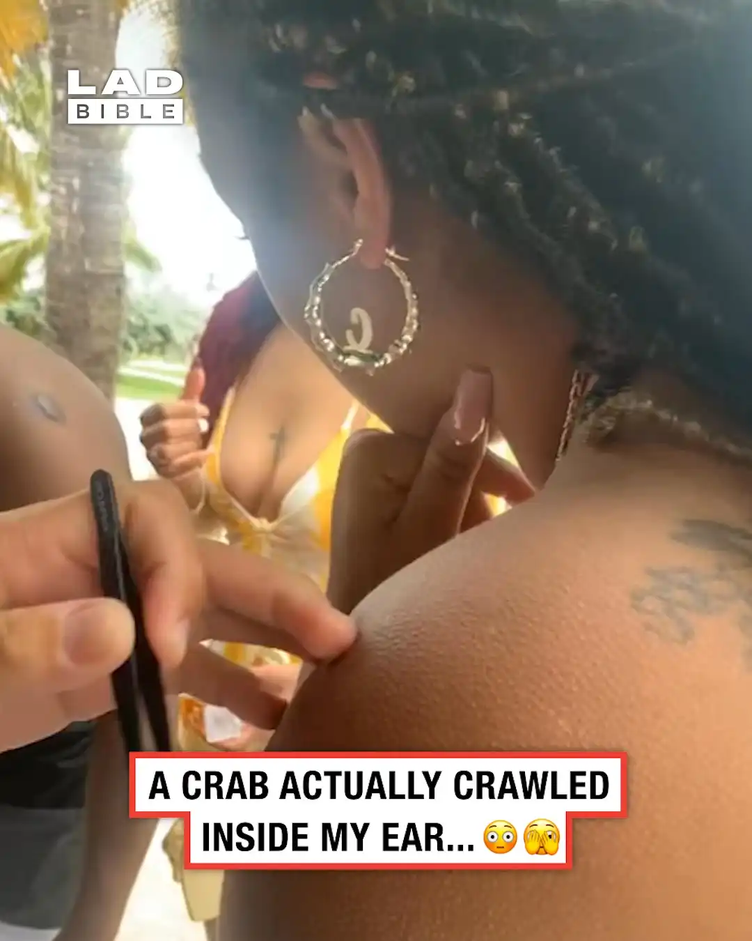 A crab crawled into my ear 🫣🦀