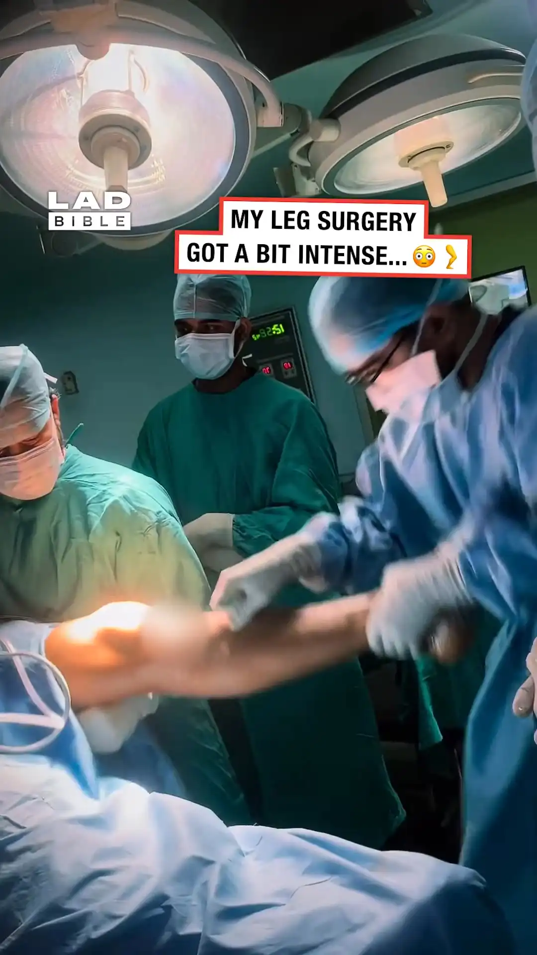 Intense leg treatment 😳