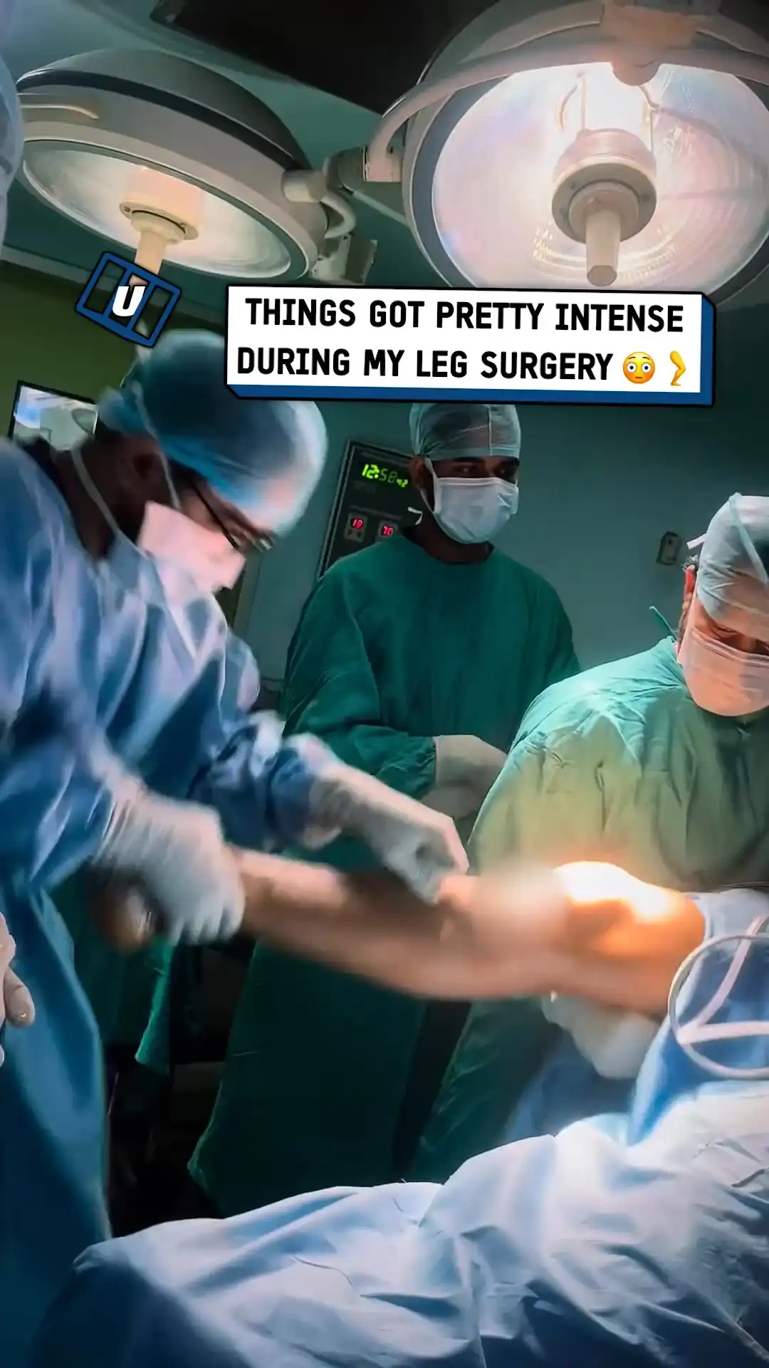 Intense ACL reconstruction 🦵😳