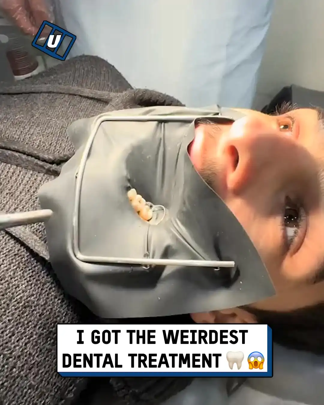 Weird dental treatment 🦷😳