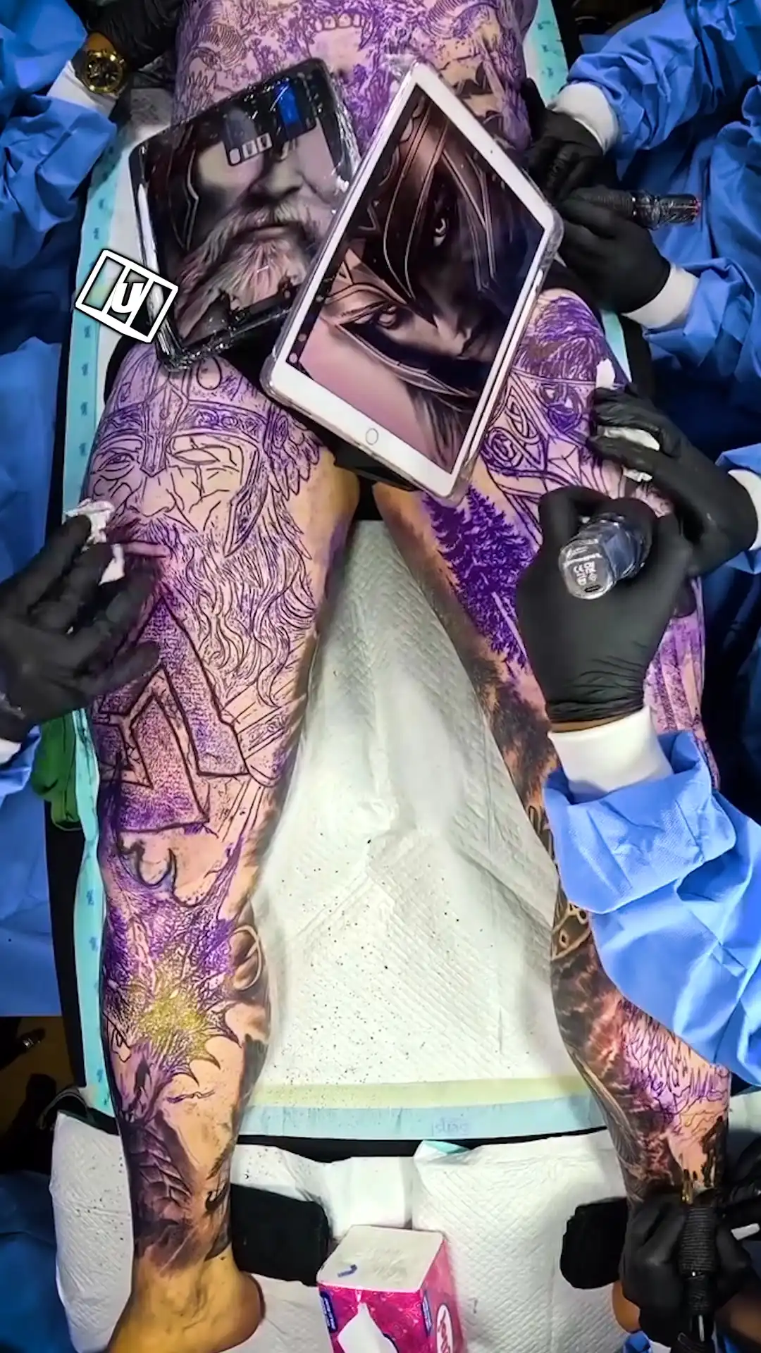 Getting this tattoo is like a full surgery