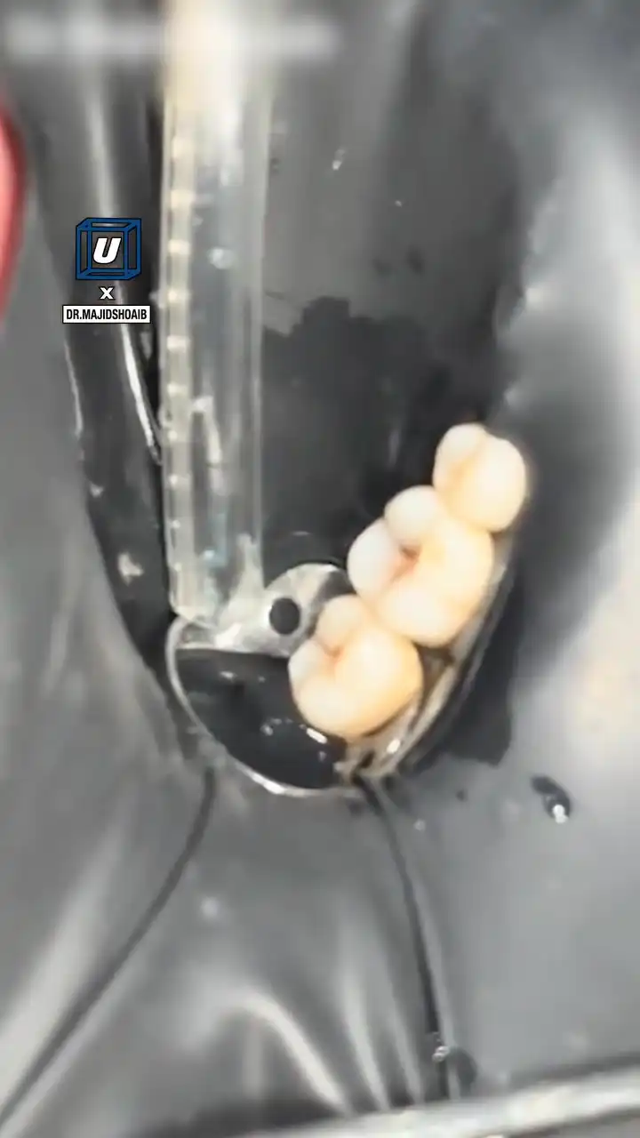 Weird dental treatment 🦷