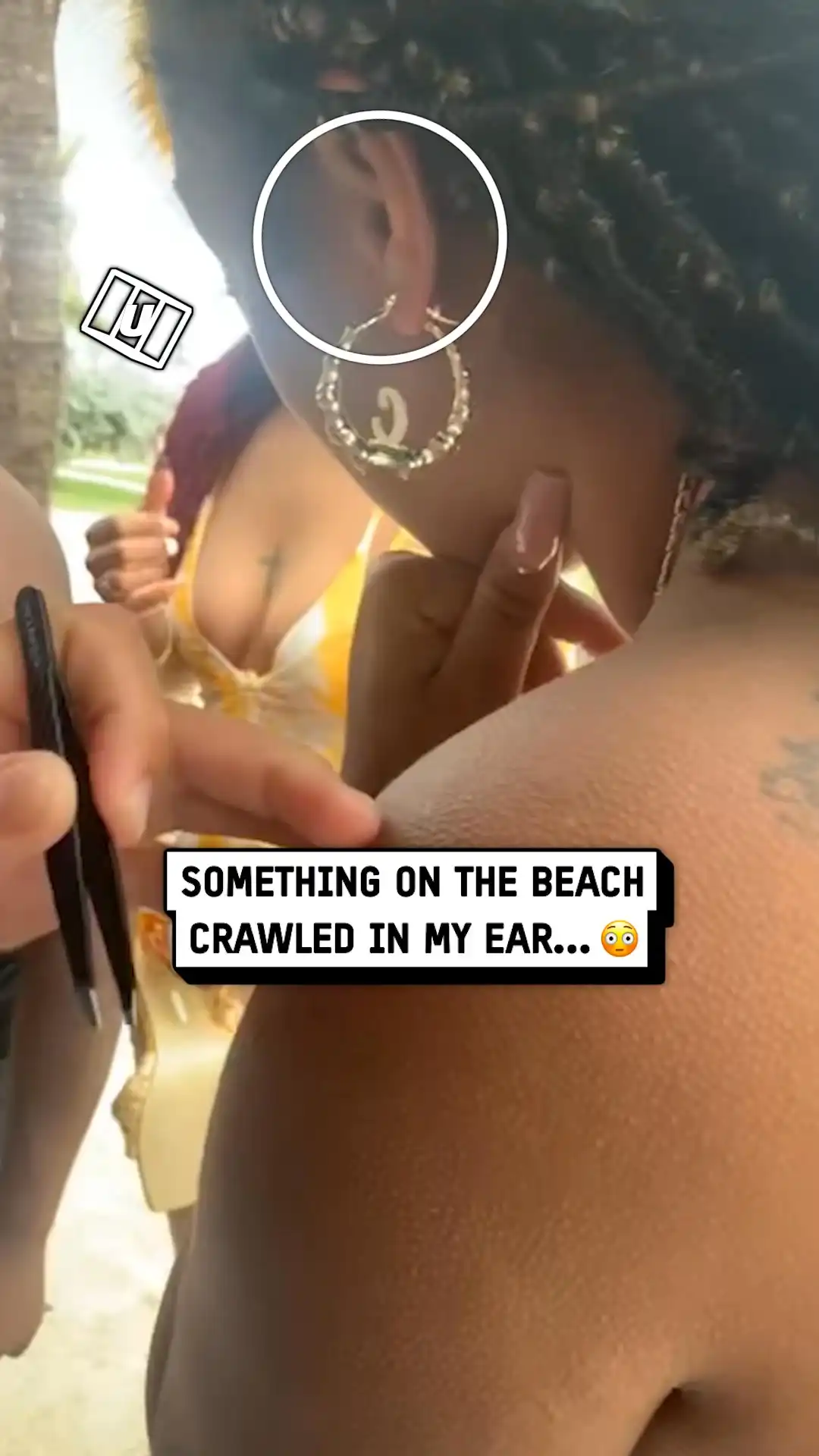 Baby crab removed from woman's ear