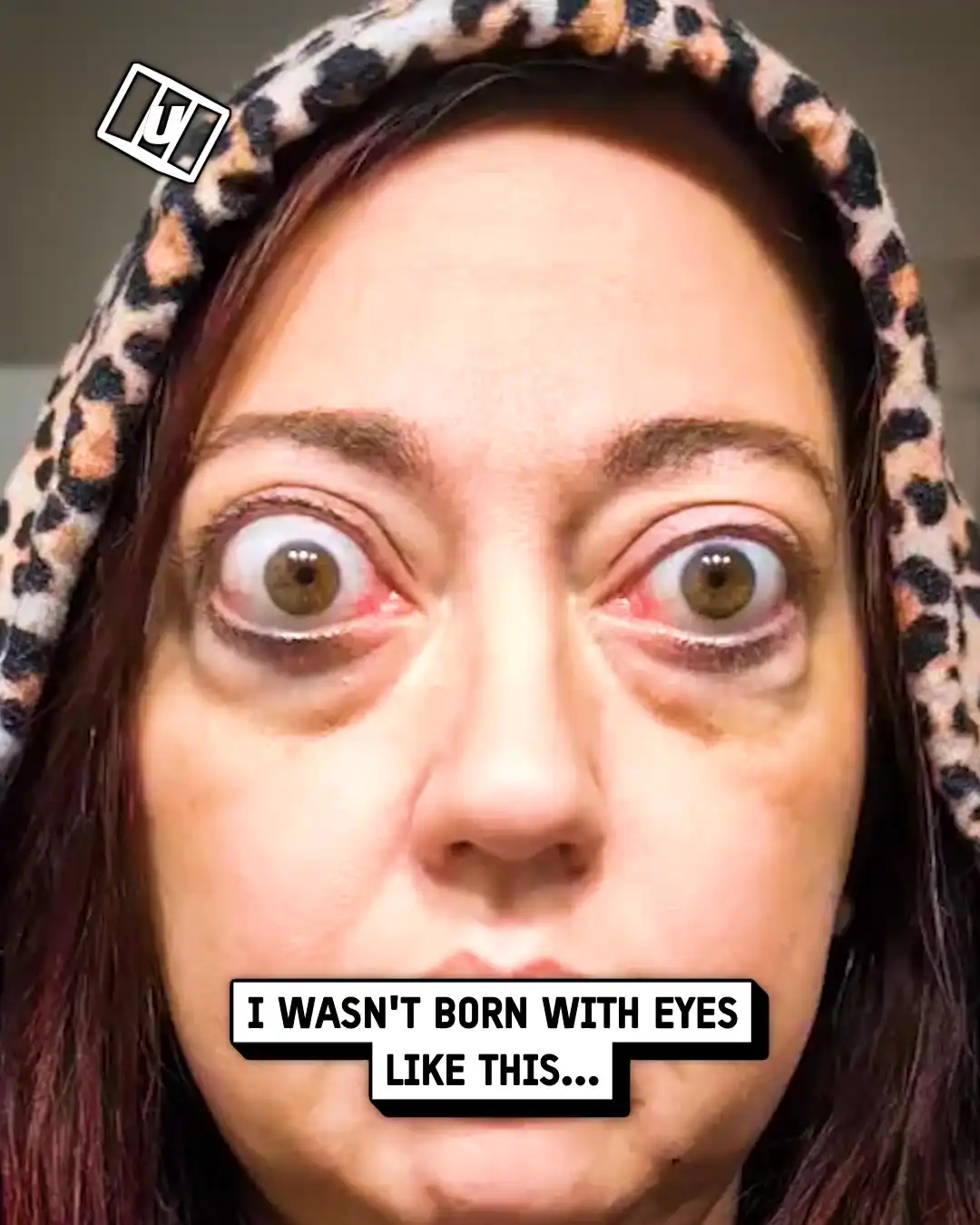 My eyes started to pop 😳