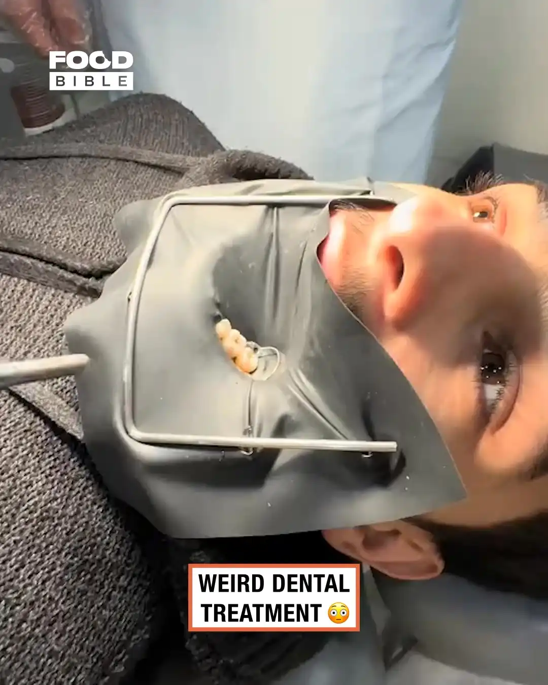 Weird dental treatment 🦷