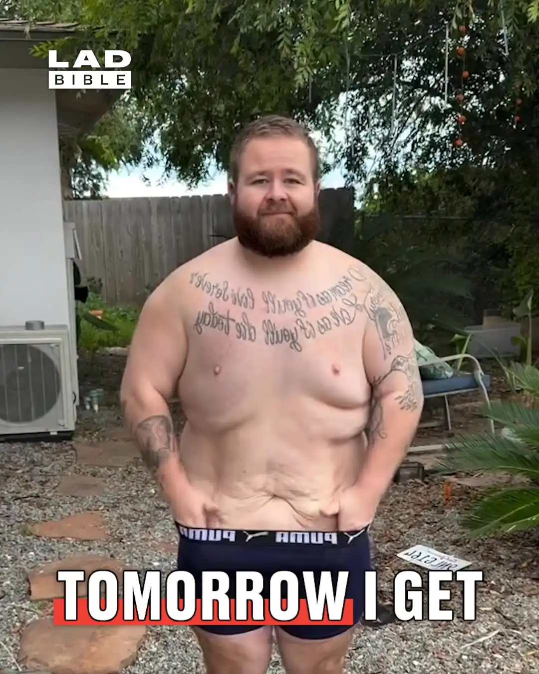 Before and After Excess Skin Removal πͺ