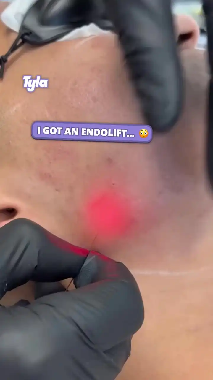 I think I'll take the surgery 😅